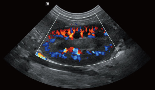 Renal blood flow of canine